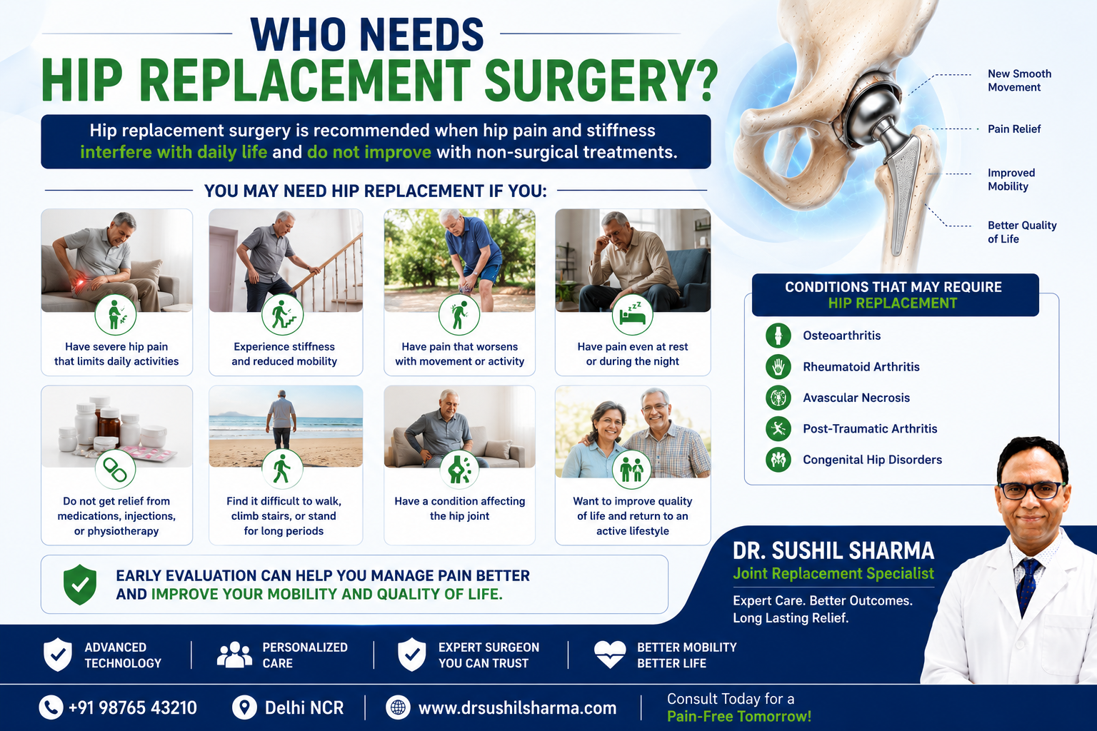 Who Needs Hip Replacement Surgery?