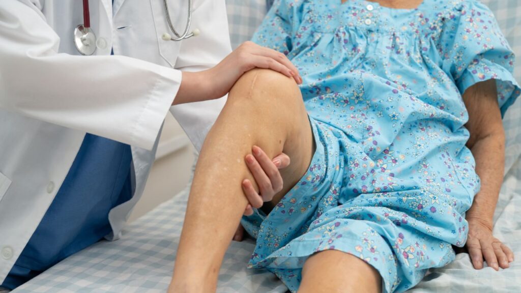 What is the Cost of Knee Replacement in Delhi NCR?