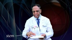 Hip replacement implant prosthesis used by Dr. Sushil Sharma